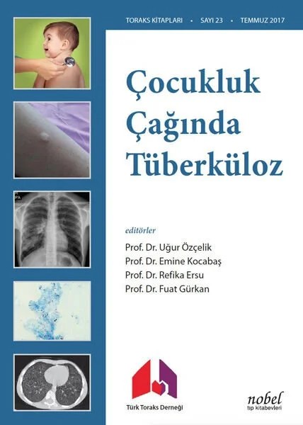 Çocukluk Çağında Tüberküloz Tanı: Tedavi ve Korumada Güncel Yaklaşımlar ve Olgu Örnekleri – - – Nobel Tıp Kitabevleri kitap kapağı