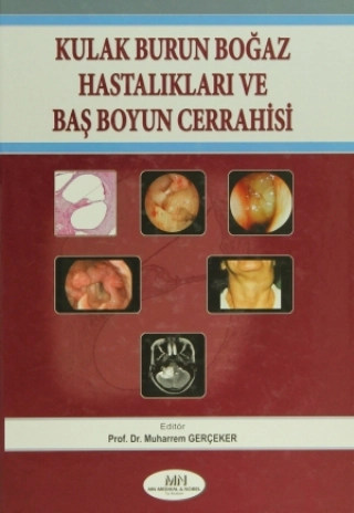 Kulak Burun Boğaz Hastalıkları Baş Boyun Cerrahisi