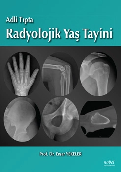 Adli Tıpta Radyolojik Yaş Tayini