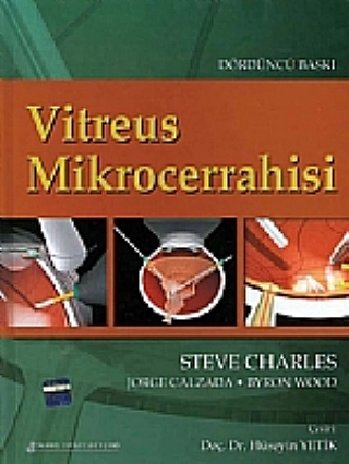 Vitreus Mikrocerrahisi