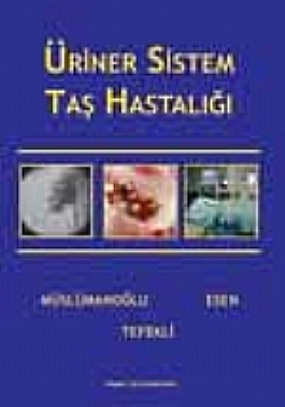 Üriner Sistem Taş Hastalıkları