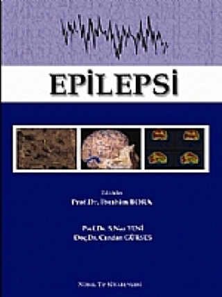 Epilepsi