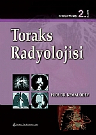 Toraks Radyolojisi 2.Baskı