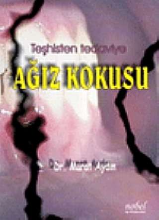 Ağız Kokusu